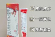 宝宝湿疹抑菌膏哪个好_宝宝湿疹抑菌膏怎么用