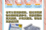 宝宝脐疝会痛吗_脐疝疼痛症状