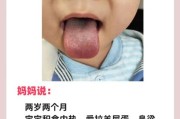 两个月宝宝爱吐舌头正常吗_需要看医生吗