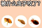 梦到虫子咬是什么预兆_梦见虫子咬自己怎么办