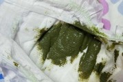 宝宝大便墨绿色偏黑正常吗_需要看医生吗