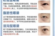 眼袋图片大全_眼袋怎么消除最有效