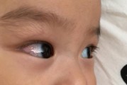 两个月宝宝眼白发蓝正常吗_婴儿眼白发蓝原因
