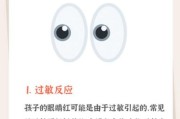 宝宝眼角发红是什么原因_怎么处理