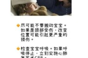 宝宝摔着头三天后去世_家长如何第一时间判断危险信号