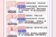 一岁宝宝屁眼红怎么办_红屁股护理方法