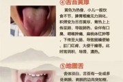 宝宝舌苔厚白怎么调理_婴儿舌苔厚白吃什么好