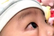 6个月宝宝眼睛有红血丝_怎么办