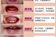 宝宝先长哪颗牙_乳牙萌出顺序