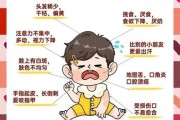 宝宝缺锌有哪些表现_怎么判断孩子缺锌