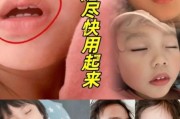 宝宝上嘴唇翘怎么矫正_婴儿翘唇纠正方法