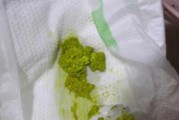 宝宝大便绿色怎么办_新生儿绿便正常吗