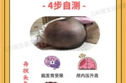 宝宝头很大正常吗_宝宝头大需要做什么检查