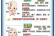 宝宝长痱子怎么办_怎么快速止痒