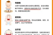 宝宝缺维生素d的症状有哪些_怎么判断
