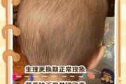 一岁宝宝头发稀少怎么回事_宝宝头发少缺什么营养