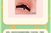 宝宝换牙是全部都换吗_乳牙全部会换吗