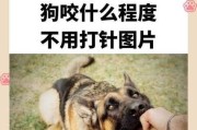 梦到狗咬手是什么意思_被狗咬手预示什么