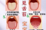 宝宝舌头黄苔怎么回事_如何处理