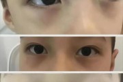 宝宝眼下发青怎么回事_宝宝眼下发青正常吗