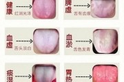 舌头图片大全_正常舌苔颜色对照
