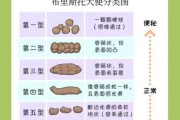 1个多月宝宝2天没拉大便怎么办_新生儿便秘原因