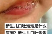 宝宝嘴巴吐泡泡怎么回事_新生儿吐泡泡正常吗
