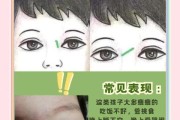 宝宝鼻梁青怎么回事_宝宝鼻梁青需要看医生吗