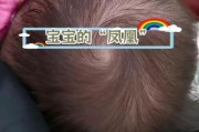宝宝凤凰头有什么说法_新生儿头型像凤凰怎么办