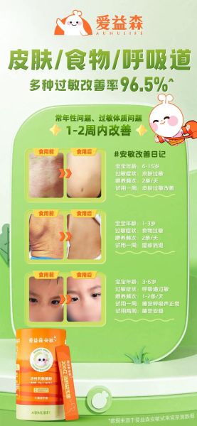 宝宝杨棉过敏症状_怎么快速缓解