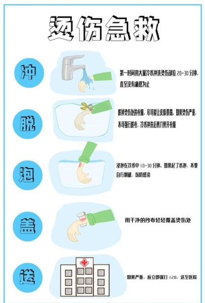 一岁宝宝烫伤怎么办_急救步骤与护理