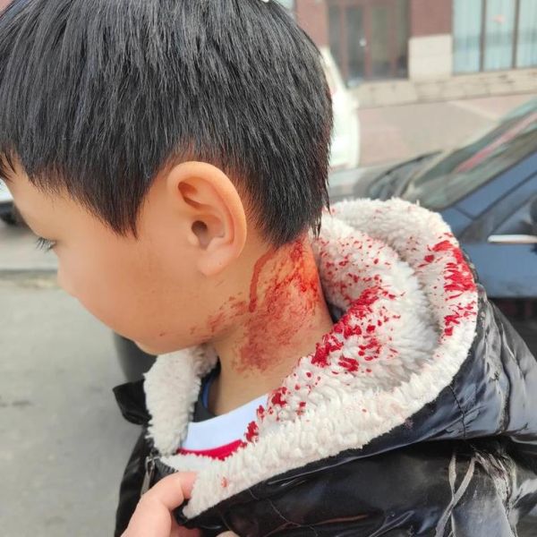 梦到头掉了是什么意思_梦到头掉了预示什么