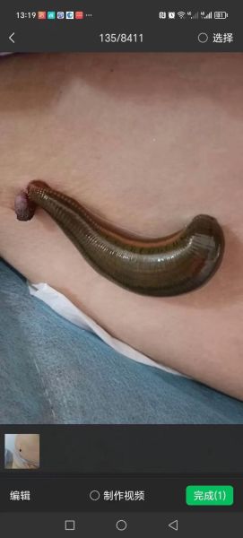 梦到蚂蝗是什么意思_梦见蚂蝗吸血怎么办