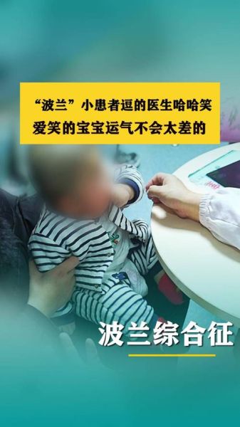 经常逗宝宝笑的危害_婴儿过度大笑的风险