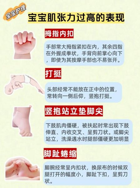 宝宝肌张力高的表现_肌张力高有什么危害