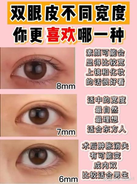 双眼皮图片大全_如何选择适合自己的双眼皮形状