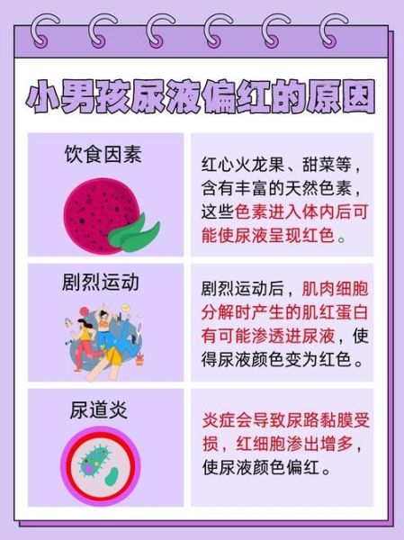 宝宝尿有点红怎么办_宝宝尿红是什么原因