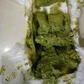 宝宝大便绿色有奶瓣怎么回事_需要看医生吗