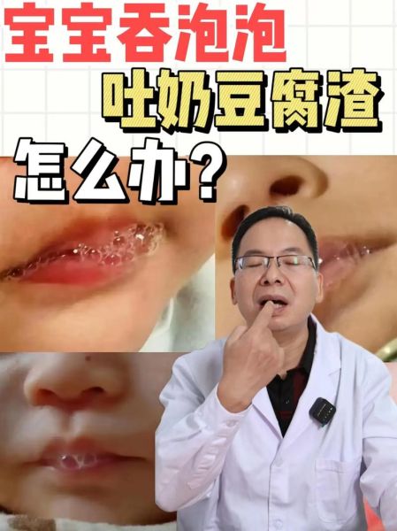宝宝吐豆腐渣一样的奶怎么办_吐奶像豆腐渣正常吗