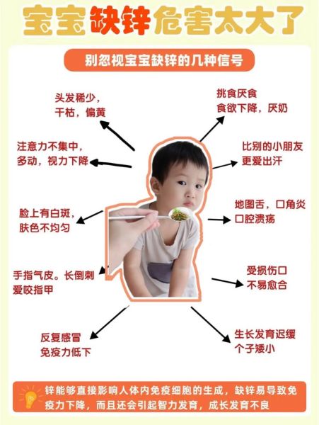 宝宝缺锌有哪些表现_怎么判断孩子缺锌