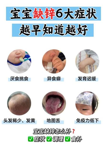宝宝缺锌有哪些表现_怎么判断孩子缺锌