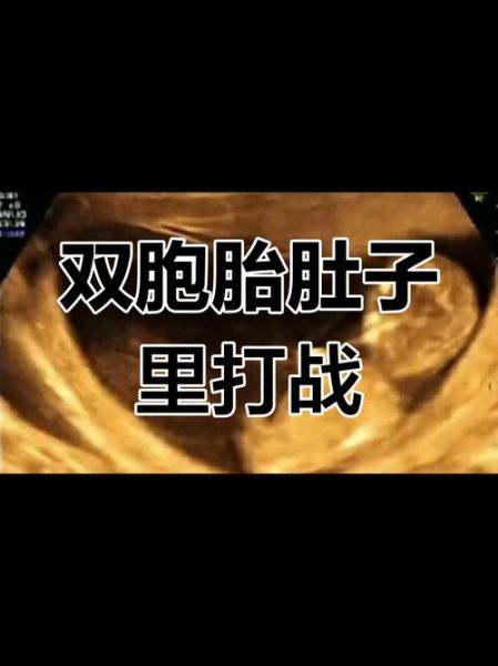 梦到和孕妇打架是什么意思_孕妇打架梦境解析