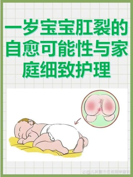 宝宝肛门小疙瘩是什么_宝宝肛门小疙瘩怎么办