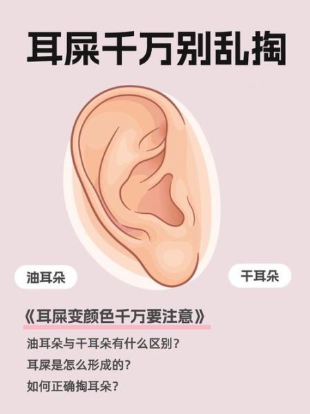 梦到扣耳屎是什么意思_梦见掏耳朵预示什么