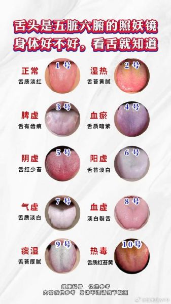 舌头图片大全_正常舌苔颜色对照