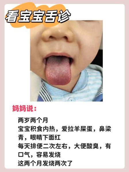 两个月宝宝爱吐舌头正常吗_需要看医生吗