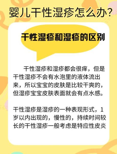 3岁宝宝湿疹反复怎么办_日常护理全攻略
