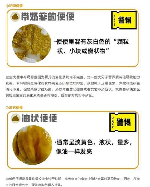 宝宝大便不正常怎么办_宝宝大便异常的原因