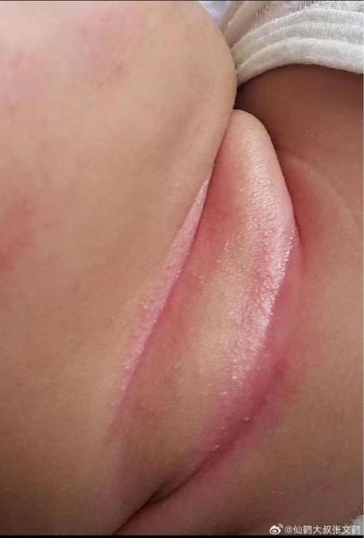 宝宝身上有鱼腥味_鱼腥味宝宝正常吗