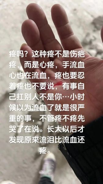 梦到伤口流血是什么意思_梦见自己受伤流血怎么办